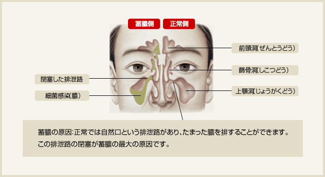 fukubi_01